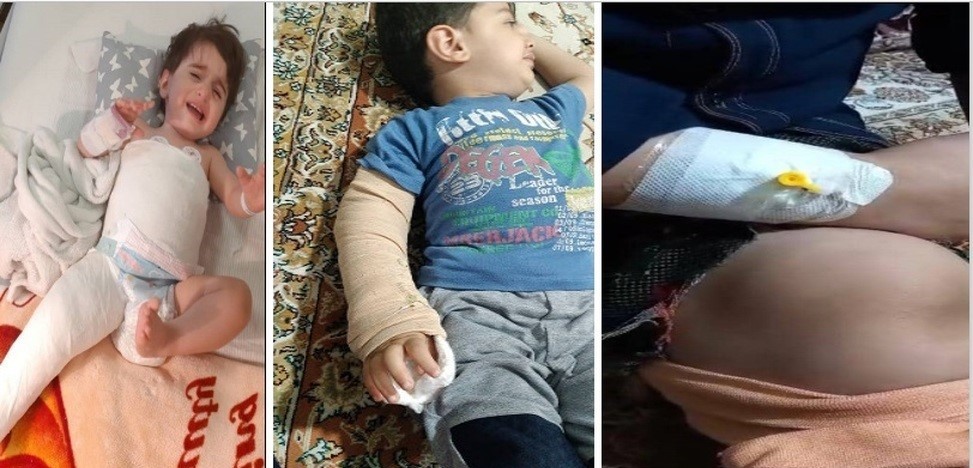 ۱۵۵۰۰ بیمار هموفیلی در کشور / ازدواج فامیلی و سابقه خانوادگی از علل خطر ابتلا